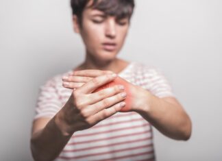 Menores no deben jugar con pirotecnia durante fiestas patrias; causan quemaduras graves e incluso amputaciones