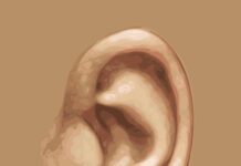 Donarán aparatos auditivos a niñas, niños y adolescentes de Baja California oido